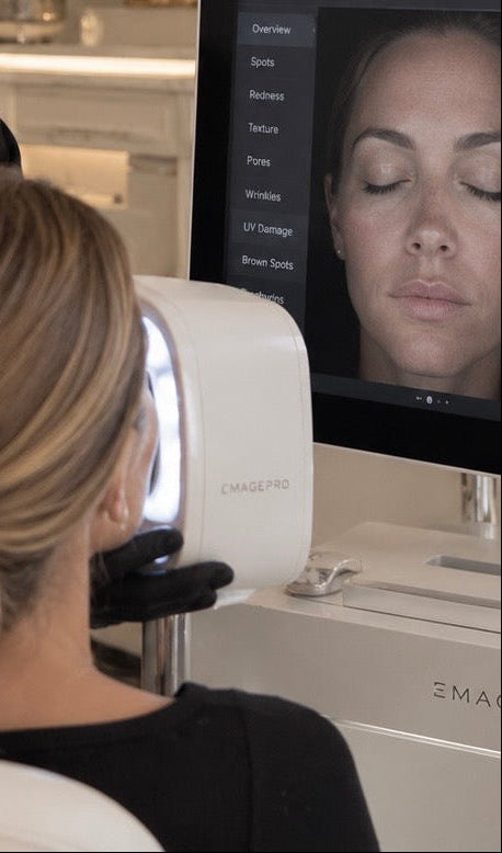 Professional skin analysis using ImagePro HALO at Skin Chateau