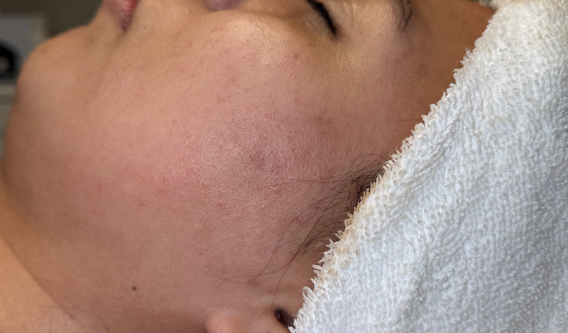 Person with a towel on their head, possibly after a bath or shower, with a blurred background.
