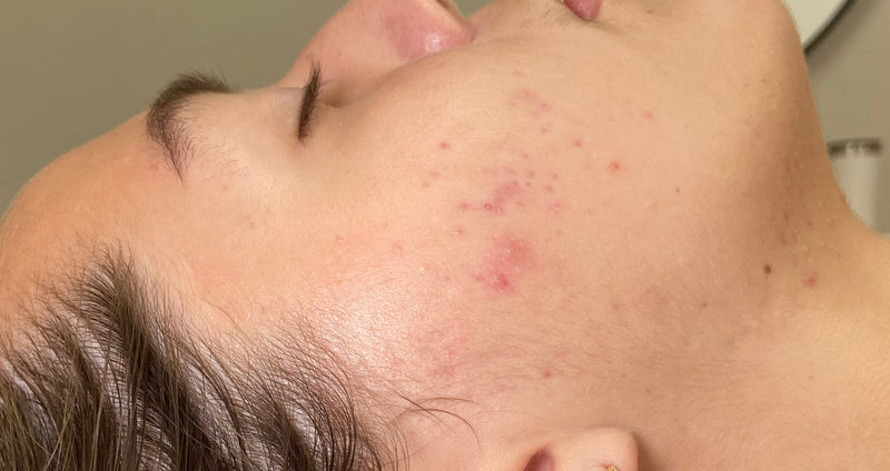 Close-up of a person wearing an earring with a blurred background