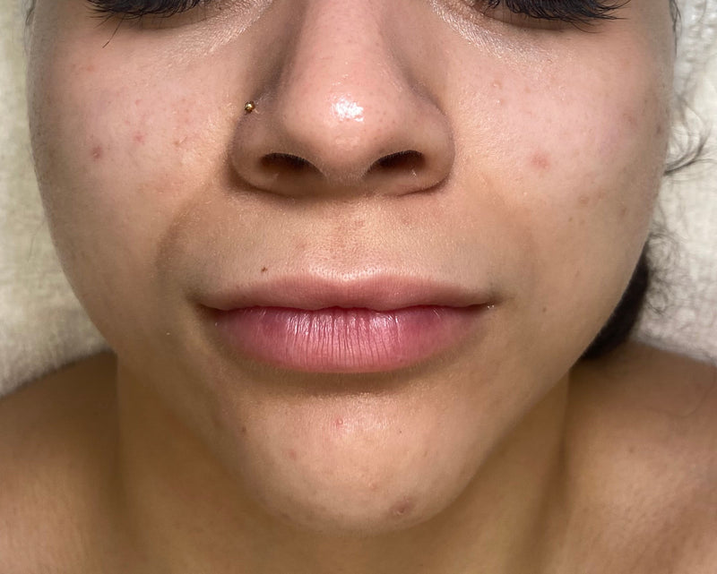 Person receiving a facial with a towel on their head