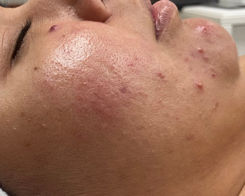 Person with a towel on their head in a bathroom setting