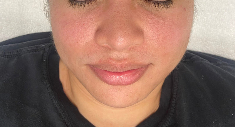 Person receiving a facial treatment with a towel on their head